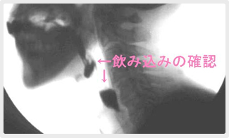 �������e�����i�u�e�����j